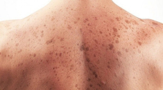 Làn da sáng hồng chỉ sau một liệu trình detox thải độc trắng da Light Fusion