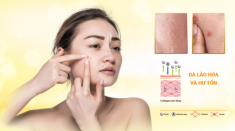 Viên uống The Collagen Extra Plus của Rosa Bonita tái tạo da từ cấp độ tế bào