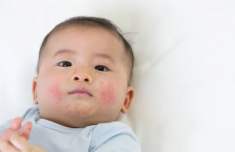 Mùa đông này, mẹ đã chọn được loại kem dưỡng ẩm phù hợp cho bé yêu chưa?