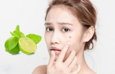 15 Cách trị thâm mụn tại nhà cấp tốc hiệu quả nhanh nhất