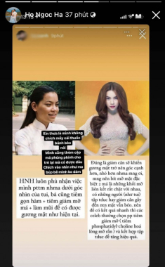 Bị nghi tiêm chích đủ thứ, Hà Hồ thắng thắn thừa nhận: “Thèm” nhưng không dám, sợ như ma búp bê