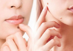 Cách tẩy nốt ruồi an toàn và hướng dẫn chăm sóc sau tẩy tại nhà
