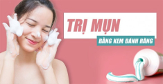 Cách trị mụn bằng kem đánh răng cực an toàn và hiệu quả tại nhà