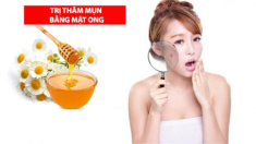 Cách trị thâm mụn tại nhà nhanh nhất an toàn và dễ dàng thực hiện