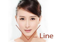 Cằm V Line: Những cách tạo hình V Line và chăm sóc hiệu quả