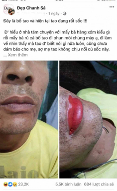 CĐM “phát sốt” với ông bố chất chơi: trốn vợ con đi phun xăm môi và cái kết bất ngờ