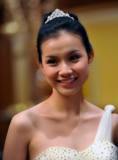 Đăng quang hơn 13 năm, nàng hậu này giờ đây mới dám đi tiêm cằm