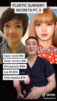 Đỉnh cao thẩm mỹ như không thẩm mỹ tại Hàn: BlackPink sửa gần hết, riêng Lisa tiêu gần 1 tỷ