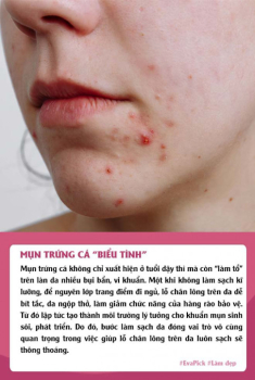 Eva Pick: Bỏ qua 2 bước skincare trước khi ngủ, chị em nhận về 6 cái hại cho làn da 