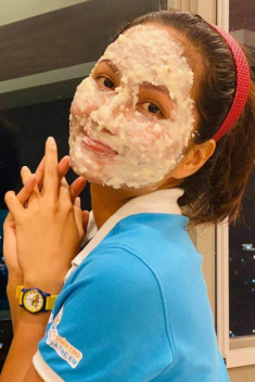 H’Hen Niê xuất hiện với gương mặt bầm dập, skincare kiểu gì mà hỏng luôn mặt tiền