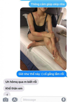 Hoảng hốt trước làn da nổi đầy mụn đỏ và ngứa vì bị dị ứng cấp tính của Hương Tràm