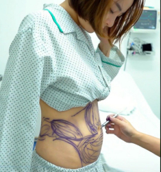 Hot girl Trâm Anh sau hút mỡ bụng, tích cực khoe thân với đồ kiệm vải