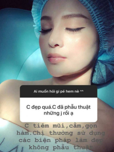 Huyền Baby tiêm filler lên mũi, cằm, thon gọn hàm để trở nên hoàn mỹ