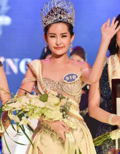 Làng nhan sắc xém nữa đã có 1 vụ kiện giữa hai mỹ nhân chỉ vì... chuyện làm răng sứ