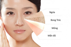 Mùa lạnh cứ ở nhà đắp mặt nạ dưỡng da thiên nhiên, đánh bật khô khốc bằng chiêu tiết kiệm