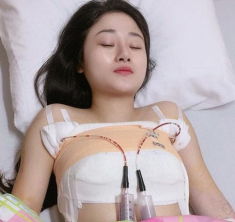 Nâng ngực chảy xệ sau sinh: Thuý Diễm, Pha Lê công khai đi đầu
