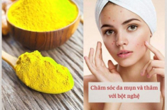 Những bí quyết phải nằm lòng khi chăm sóc da mụn, nàng làm theo Tết này da căng bóng