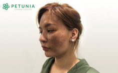 Petunia Charm Center - những khác biệt của hệ thống làm đẹp ứng dụng công nghệ sinh học