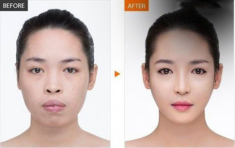Phẫu thuật gần hết khuôn mặt, các hotgirl mạng xã hội ngày ấy giờ thế nào? 