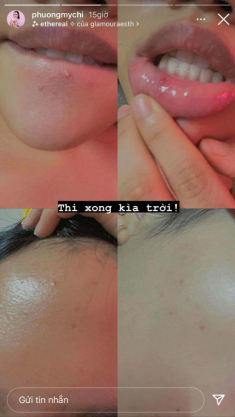 Phương Mỹ Chi mếu máo vì chăm da: skincare cật lực nhưng “skin không care”, nguyên nhân ai cũng mắc