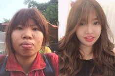 Phượng Thị Nở vừa vượt cạn sinh thêm con hậu dao kéo mặt, diện mạo đứa trẻ thật may mắn