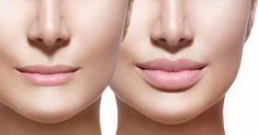 Sau khi tiêm filler, nàng tuyệt đối nên tránh xa những loại thực phẩm này