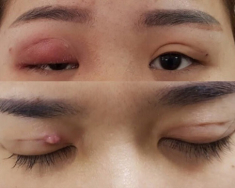 Thẩm mỹ Beauty Center by Tấm - địa chỉ thẩm mỹ đạt tiêu chuẩn của Bộ Y tế