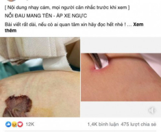 Trước khi cai sữa mặc con chắp tay xin, Hòa Minzy phải mổ áp-xe ngực nổi cục như trứng gà