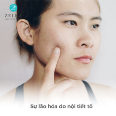 Tư duy chăm sóc da toàn diện theo “hệ sinh thái thẩm mỹ” tại Zelda