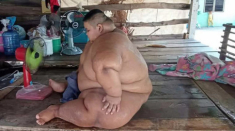Từ nhỏ bị ép ăn cho chóng lớn, bé 13 tuổi nặng 200kg, mẹ mất giờ không ai nuôi