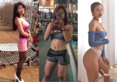 Từng nhập viện vì suy dinh dưỡng, cô gái lột xác thành bản sao “Kim siêu vòng 3”