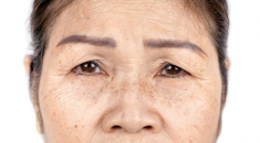 VK8 Collagen Therapy Essence – Tinh chất chống lão hóa mang lại hiệu quả cao