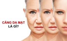 Căng da mặt và những điều cần biết để tránh hiểm họa khôn lường