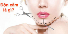 Độn cằm V Line là gì? Độn cằm có đau và nguy hiểm không?