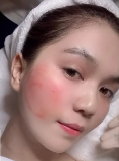 Ngọc Trinh xuất hiện với gương mặt chảy máu, chuyện gì thế này!
