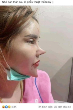 Người phụ nữ trẻ đẹp bỗng hoá phù thuỷ vì thẩm mỹ quá tay