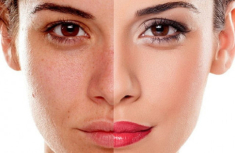 Giải mã Pharmaform Skin Brightener - serum trắng da, giảm thâm nám chỉ sau 4 tuần