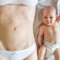 Hệ tiêu hóa của trẻ sinh mổ và những điều mẹ cần biết!