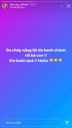 Hotgirl có tài sản 50 tỷ kêu cứu vì bị lột da, chị em đi biển nên cẩn thận