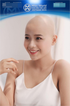 Thí sinh có câu chuyện đặc biệt đi thi hoa hậu, chưa kịp nổi đã bị “ném đá”