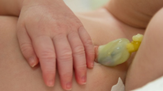 Chăm sóc trẻ sơ sinh rụng rốn nhưng chưa khô