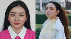 Hotgirl miền Tây lấy tỷ phú Thái đi nâng cơ mặt nhận về cái kết kích ứng bỏng da
