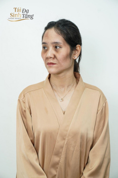Tái sinh đa tầng đồng hành cùng bạn trên chặng đường làm đẹp chiến thắng thời gian và tuổi tác
