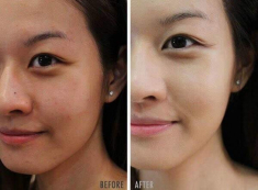 Ưu và khuyết của những lọ kem dưỡng trắng da đang hot, có loại chỉ từ 279k