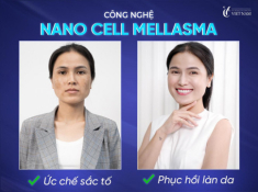 Công nghệ trị nám Nanocell Melasma - Vực dậy niềm tin chữa nám cho hàng triệu chị em 