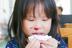 Nguyên nhân trẻ bị chảy máu cam do đâu?