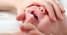 Trẻ sơ sinh bị nấm miệng phải làm sao?