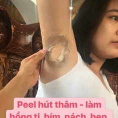 Bóc trần chiêu trò peel da như thật của “vũ trụ hotgirl bán hàng online”: Một cú lừa ngoạn mục!