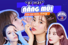 Nâng mũi Idol Line - Trào lưu số 1 của các Idol Kpop