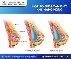 Nâng ngực có cho con bú được không? Lời giải đáp từ bác sĩ Phan Huy Hoàng